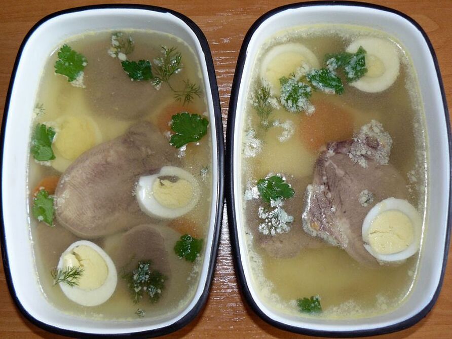 Aspic fun kneeee arthrosis