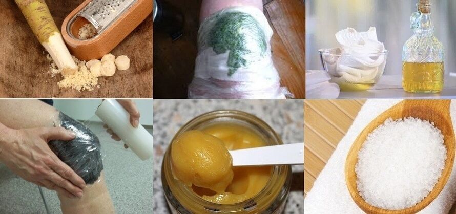 Awọn atunṣe eniyan fun arthrosis ti apapọ orokun